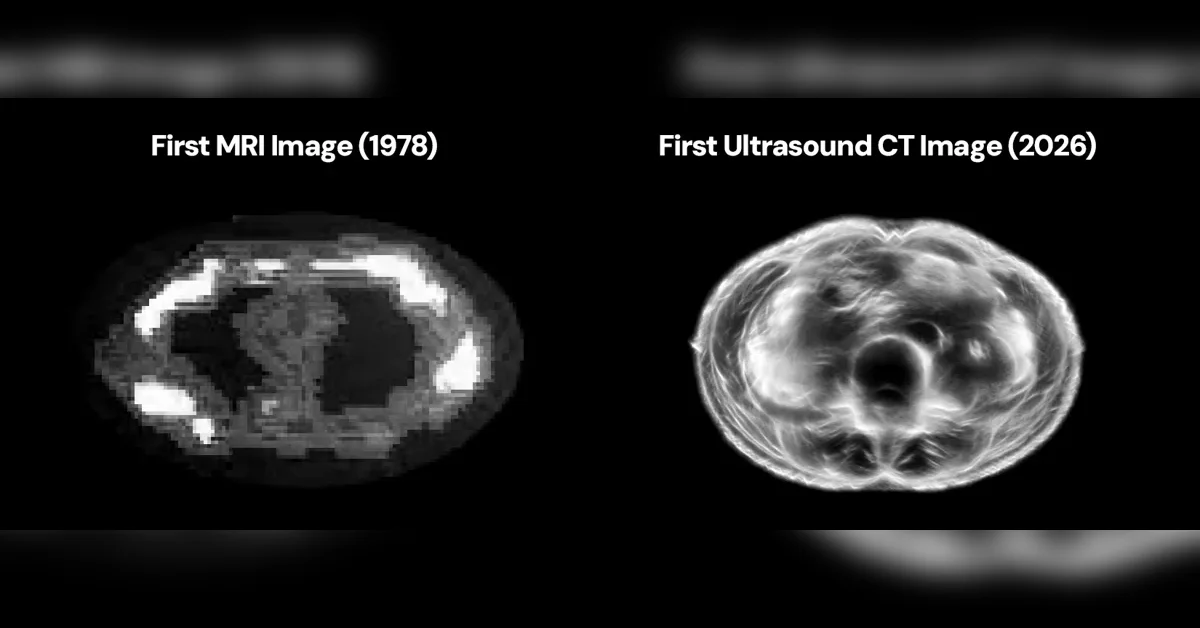 [Midjourney Scanner] 60 second ultrasound-based full-body scanner that beats MRI